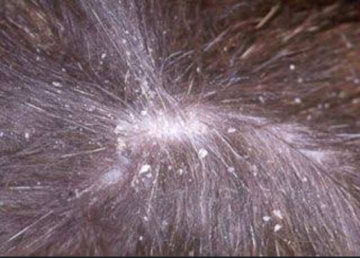 puppy skin infection called dandruff