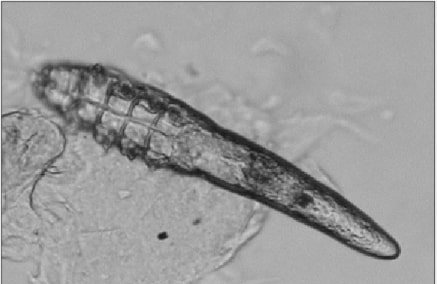 Demodex mites